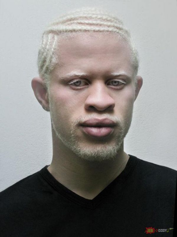 Ej bo ciekawi mnie jak we wczesnej Ameryce byli traktowani murzyni albinosi?