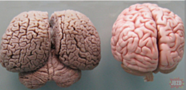 mózg człowieka i mózg delfina