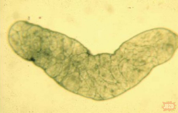 Dicrocoelium dendriticum - motyliczka wątrobowa